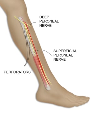 iconfibula